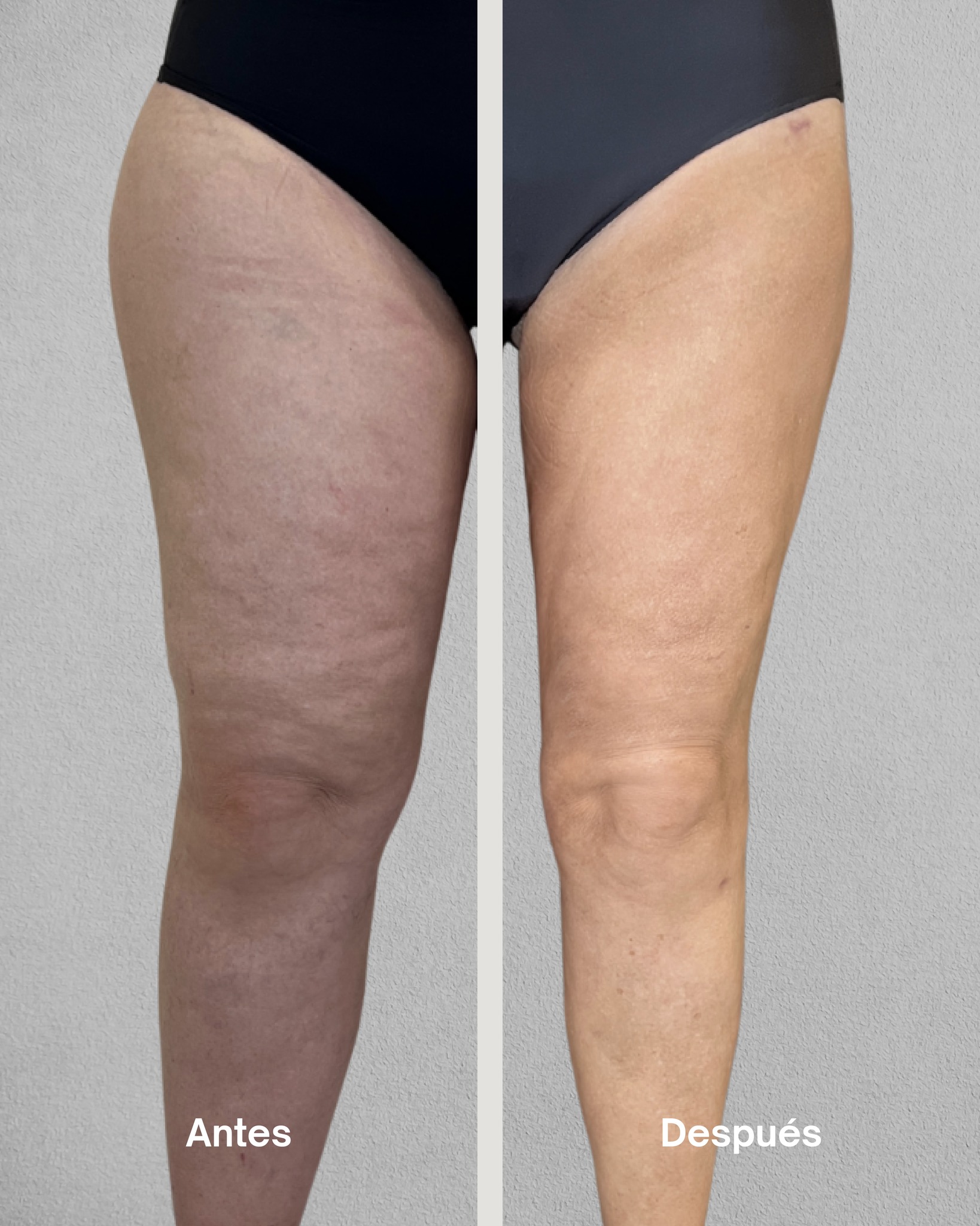 515018336_1160586522754698_466507584233334776_n