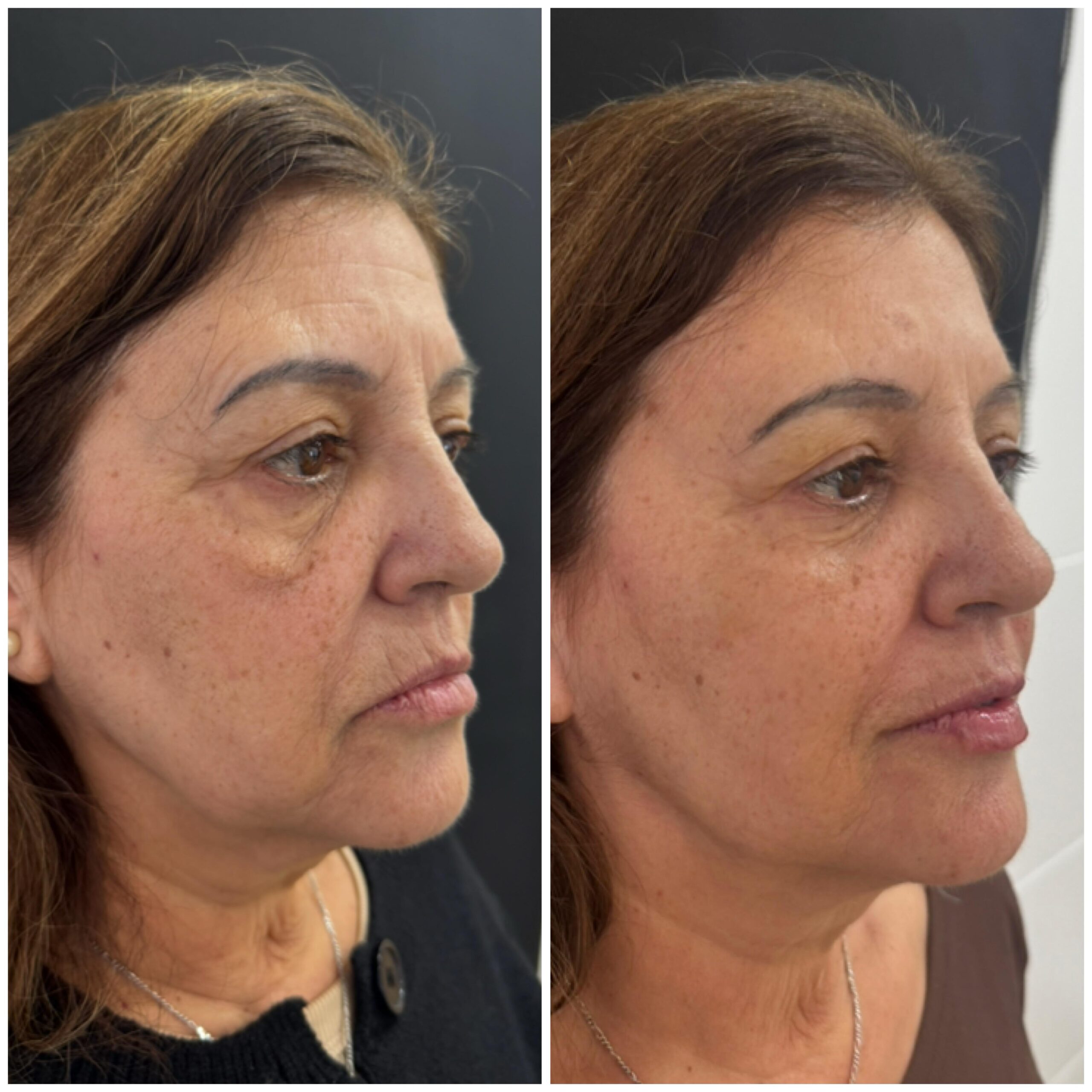 WhatsApp Image 2025-12-16 at 14.47.36